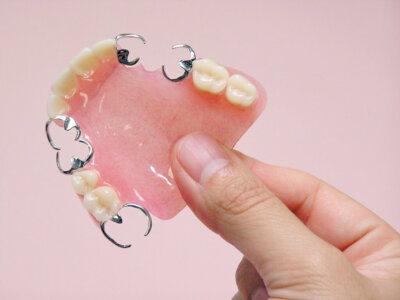 義歯の治療手順